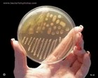 beta streptococcus equi
